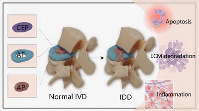 The potential mechanisms and application prospects of non-coding RNAs in intervertebral disc degeneration